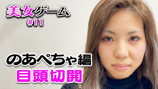 美女ゲーム 11 のあぺちゃの整形に密着 目頭切開 Egg 公式サイト
